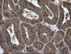 UBE2G2 Monoclonal Antibody (OTI9F2), TrueMAB , OriGene 100 &mu;L; Unconjugated:Antibodies,