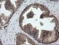 UBE2G2 Monoclonal Antibody (OTI9F2), TrueMAB , OriGene 100 &mu;L; Unconjugated:Antibodies,