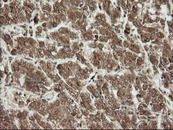 UBE2G2 Monoclonal Antibody (OTI9F2), TrueMAB , OriGene:Antibodies:Primary
