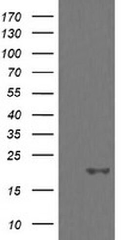 UBE2G2 Monoclonal Antibody (OTI5F1), TrueMAB , OriGene 100 &mu;L; Unconjugated:Antibodies,