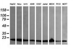 UBE2G2 Monoclonal Antibody (OTI5F1), TrueMAB , OriGene 100 &mu;L; Unconjugated:Antibodies,