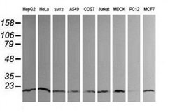 UBE2G2 Monoclonal Antibody (OTI1D7), TrueMAB , OriGene 30 &mu;L; Unconjugated:Antibodies,