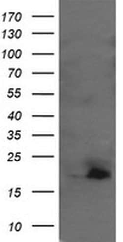 UBE2G2 Monoclonal Antibody (OTI1B10), TrueMAB , OriGene:Antibodies:Primary