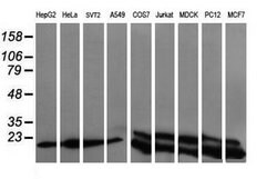 UBE2G2 Mouse anti-Canine, Human, Mouse, Rat, Clone: OTI1D2, lyophilized,