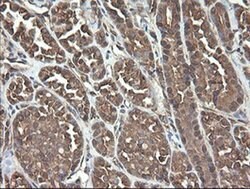 UBE2J1 Monoclonal Antibody (OTI3C11), TrueMAB , OriGene 100 &mu;L; Unconjugated:Antibodies,
