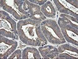 UBE2J1 Monoclonal Antibody (OTI3C11), TrueMAB , OriGene 100 &mu;L; Unconjugated:Antibodies,