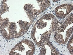 UBE2J1 Monoclonal Antibody (OTI3C11), TrueMAB , OriGene 100 &mu;L; Unconjugated:Antibodies,