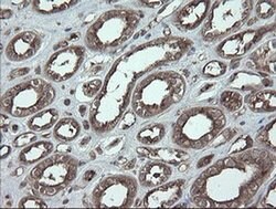 UBE2J1 Monoclonal Antibody (OTI3C11), TrueMAB , OriGene:Antibodies:Primary