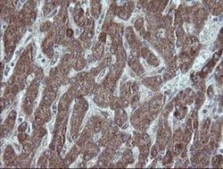 UBE2J1 Monoclonal Antibody (OTI3C11), TrueMAB , OriGene:Antibodies:Primary