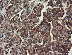 UBE2J1 Mouse anti-Human, Clone: OTI3E6, lyophilized, TrueMAB 100 &mu;g;