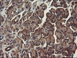 UBE2J1 Monoclonal Antibody (OTI3E6), TrueMAB , OriGene 100 &mu;L; Unconjugated:Antibodies,