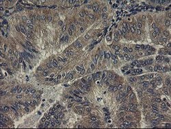 UBE2J1 Mouse anti-Human, Clone: OTI3E6, lyophilized, TrueMAB 100 &mu;g;