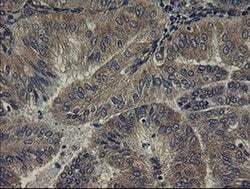 UBE2J1 Monoclonal Antibody (OTI3E6), TrueMAB , OriGene 100 &mu;L; Unconjugated:Antibodies,