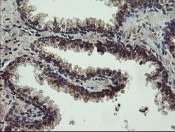 UBE2J1 Mouse anti-Human, Clone: OTI3E6, lyophilized, TrueMAB 100 &mu;g;