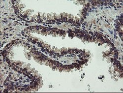 UBE2J1 Monoclonal Antibody (OTI3E6), TrueMAB , OriGene 100 &mu;L; Unconjugated:Antibodies,