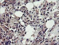 UBE2J1 Monoclonal Antibody (OTI3E6), TrueMAB , OriGene 100 &mu;L; Unconjugated:Antibodies,