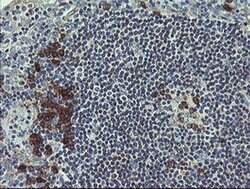 UBE2J1 Monoclonal Antibody (OTI3E6), TrueMAB , OriGene 100 &mu;L; Unconjugated:Antibodies,