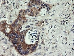 UBE2J1 Monoclonal Antibody (OTI3E6), TrueMAB , OriGene 100 &mu;L; Unconjugated:Antibodies,