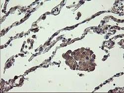 UBE2J1 Monoclonal Antibody (OTI3E6), TrueMAB , OriGene 100 &mu;L; Unconjugated:Antibodies,
