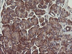 UBE2J1 Monoclonal Antibody (OTI1F6), TrueMAB , OriGene 100 &mu;L | Buy Online | Origene Technologies | Fisher Scientific