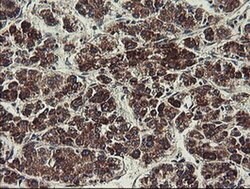 UBE2J1 Monoclonal Antibody (OTI1F6), TrueMAB , OriGene 100 &mu;L | Buy Online | Origene Technologies | Fisher Scientific
