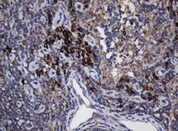 UBE2J1 Monoclonal Antibody (OTI3D5), TrueMAB , OriGene 100 &mu;L; Unconjugated:Antibodies,