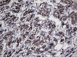 UBE2J1 Monoclonal Antibody (OTI3D5), TrueMAB , OriGene 100 &mu;L; Unconjugated:Antibodies,