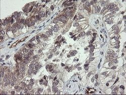 UBE2J1 Monoclonal Antibody (OTI1C7), TrueMAB , OriGene 30 &mu;L; Unconjugated:Antibodies,