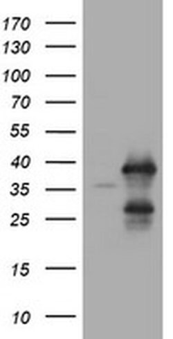 UBE2J1 Monoclonal Antibody (OTI3C11), TrueMAB , OriGene 100 &mu;L; Unconjugated:Antibodies,