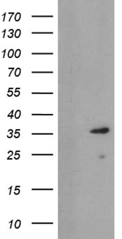 UBE2J1 Mouse anti-Human, Clone: OTI3E6, lyophilized, TrueMAB 100 &mu;g;