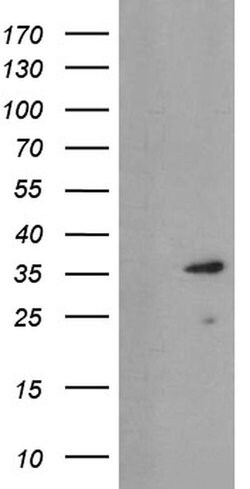 UBE2J1 Monoclonal Antibody (OTI3E6), TrueMAB , OriGene 100 &mu;L; Unconjugated:Antibodies,