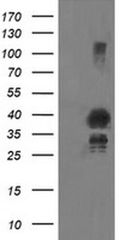 UBE2J1 Monoclonal Antibody (OTI2D4), TrueMAB , OriGene 100 &mu;L; Unconjugated:Antibodies,