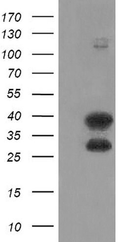 UBE2J1 Monoclonal Antibody (OTI1H10), TrueMAB , OriGene:Antibodies:Primary