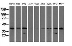 UBE2J1 Monoclonal Antibody (OTI1F6), TrueMAB , OriGene 100 &mu;L | Buy Online | Origene Technologies | Fisher Scientific