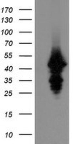 UBE2J1 Mouse anti-Canine, Human, Mouse, Rat, Clone: OTI3D1, lyophilized,