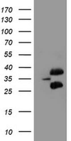 UBE2J1 Monoclonal Antibody (OTI2G2), TrueMAB , OriGene 100 &mu;L; Unconjugated:Antibodies,