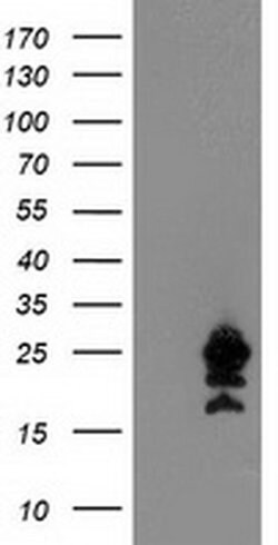 UBE2M Mouse anti-Canine, Human, Mouse, Clone: OTI2D9, liquid, TrueMAB 100
