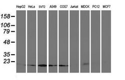 UBE2M Mouse anti-Canine, Human, Mouse, Clone: OTI2D9, liquid, TrueMAB 100