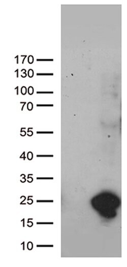 UBE2NL Mouse anti-Human, Clone: OTI8E6, lyophilized, TrueMAB 100 &mu;g;