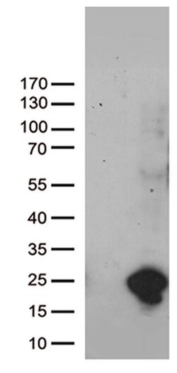 UBE2NL Monoclonal Antibody (OTI8E6), TrueMAB , OriGene 100 &mu;L; Unconjugated:Antibodies,