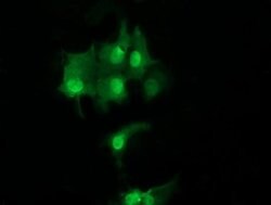 UBE2S Monoclonal Antibody (OTI4G2), TrueMAB , OriGene 30 &mu;L; Unconjugated:Antibodies,