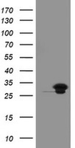 UBE2S Monoclonal Antibody (OTI1B5), TrueMAB , OriGene 30 &mu;L; Unconjugated:Antibodies,