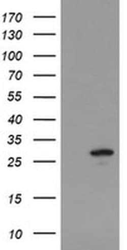 UBE2S Monoclonal Antibody (OTI4E4), TrueMAB , OriGene 30 &mu;L; Unconjugated:Antibodies,
