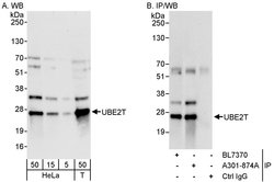 UBE2T Rabbit anti-Human, Polyclonal, Bethyl Laboratories 100 &mu;L; Unconjugated:Antibodies,