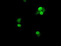 UBE2T Mouse anti-Human, Clone: OTI2F5, lyophilized, TrueMAB 100 &mu;g;