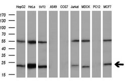UBE2T Mouse anti-Human, Clone: OTI2F5, lyophilized, TrueMAB 100 &mu;g;