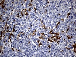 UBE3B Monoclonal Antibody (OTI3F10), TrueMAB , OriGene 30 &mu;L; Unconjugated:Antibodies,