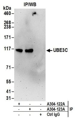 UBE3C Rabbit anti-Human, Polyclonal, Bethyl Laboratories 100 &mu;L; Unconjugated:Antibodies,