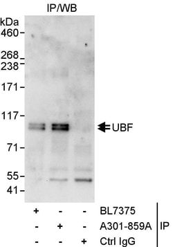 UBF Rabbit anti-Human, Polyclonal, Bethyl Laboratories 100 &mu;L; Unconjugated:Antibodies,