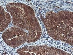 UBOX5 Monoclonal Antibody (OTI1C5), TrueMAB , OriGene 100 &mu;L; Unconjugated:Antibodies,